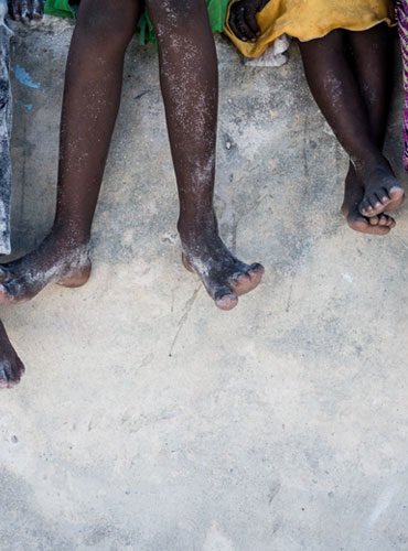 The Last Day of World Hunger Month news 11
